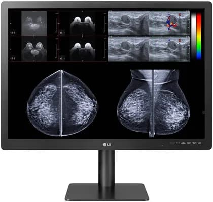 LG Diagnostic Monitor for Mammography, 31-inch 12MP 4200x2800 IPS Display, 1200 cd/m Brightness, DICOM Compliant, Pathology Mode, Focus View, Self Calibration, Ergonomic Stand, Black | 31HN713D